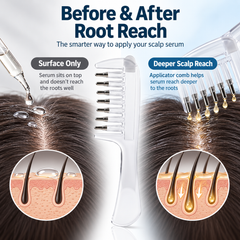2 in 1 Scalp Oil Applicator Comb