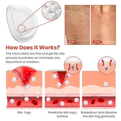 Derma Smooth Skin Tag Removal Patch (72 Patches)